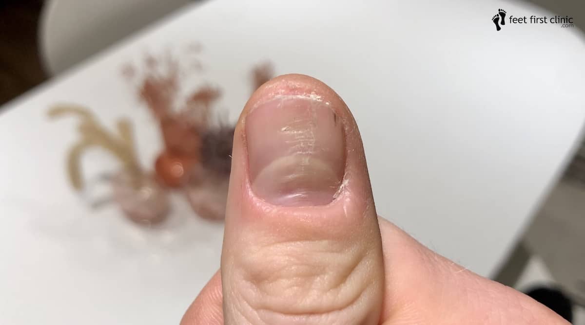 Habit-tic deformity