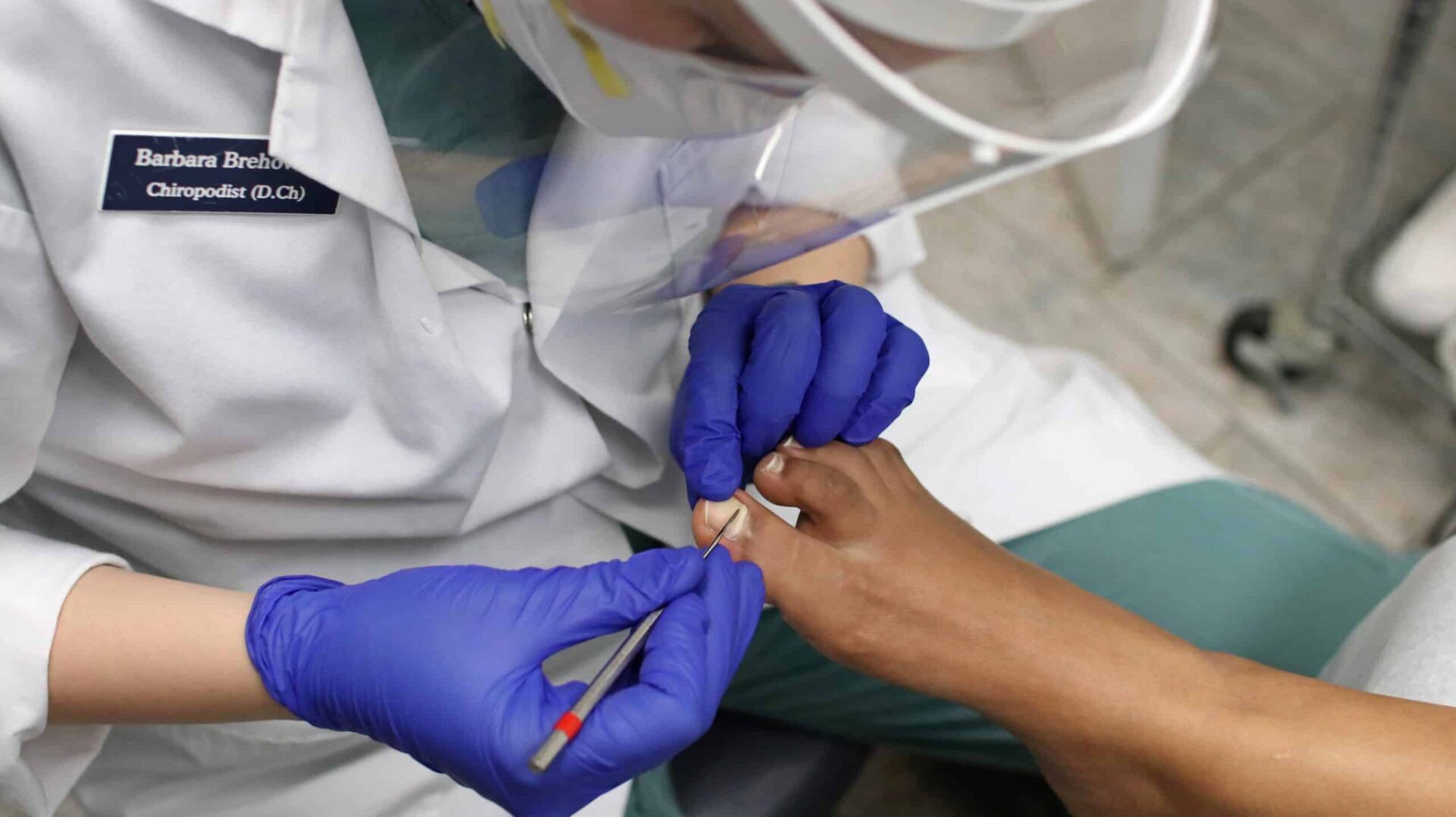 Does a Cracked Toenail Grow Back? Explained Feet First Clinic