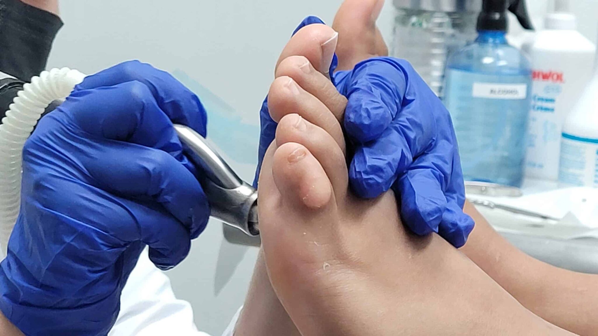 10 Reasons to Get a Medical Pedicure Feet First Clinic