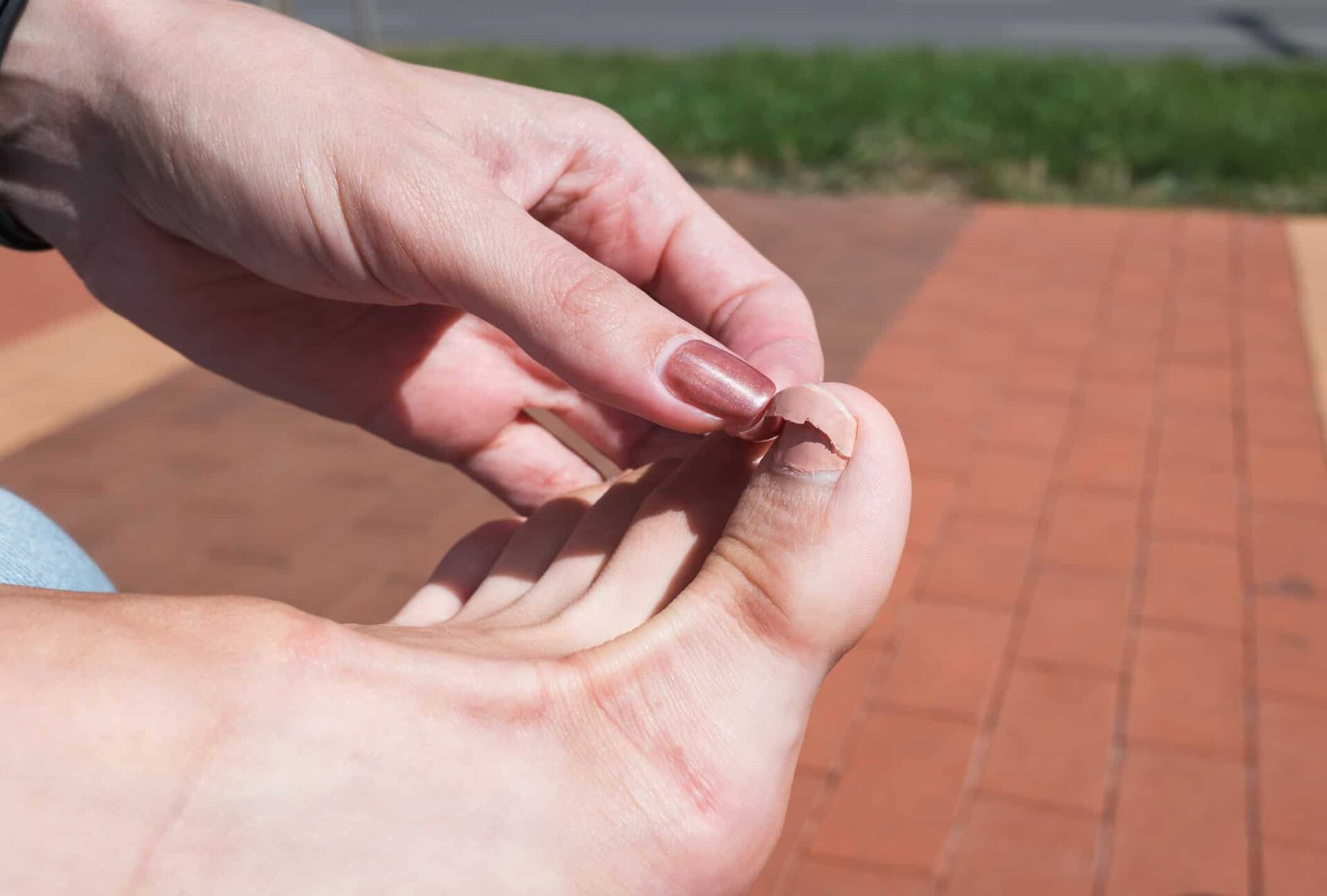 steps-how-to-treat-a-broken-nail-of-dog-the-fit-pets