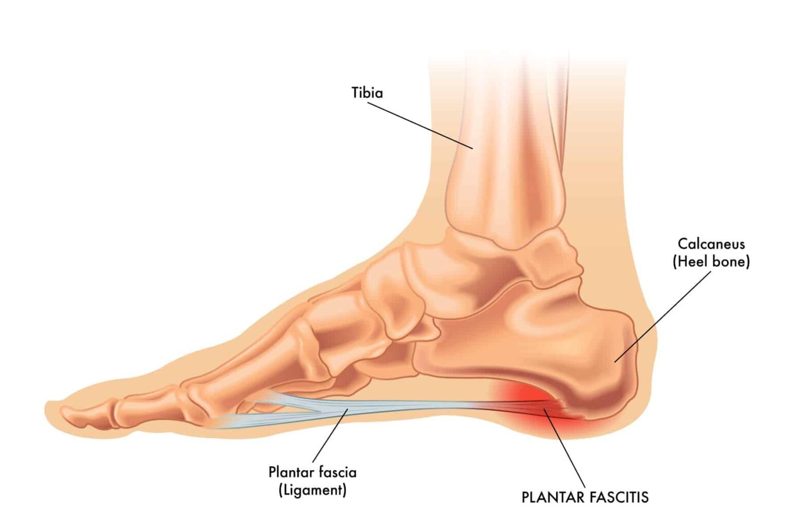 foot-pain-that-comes-and-goes-5-reasons-why-feet-first-clinic