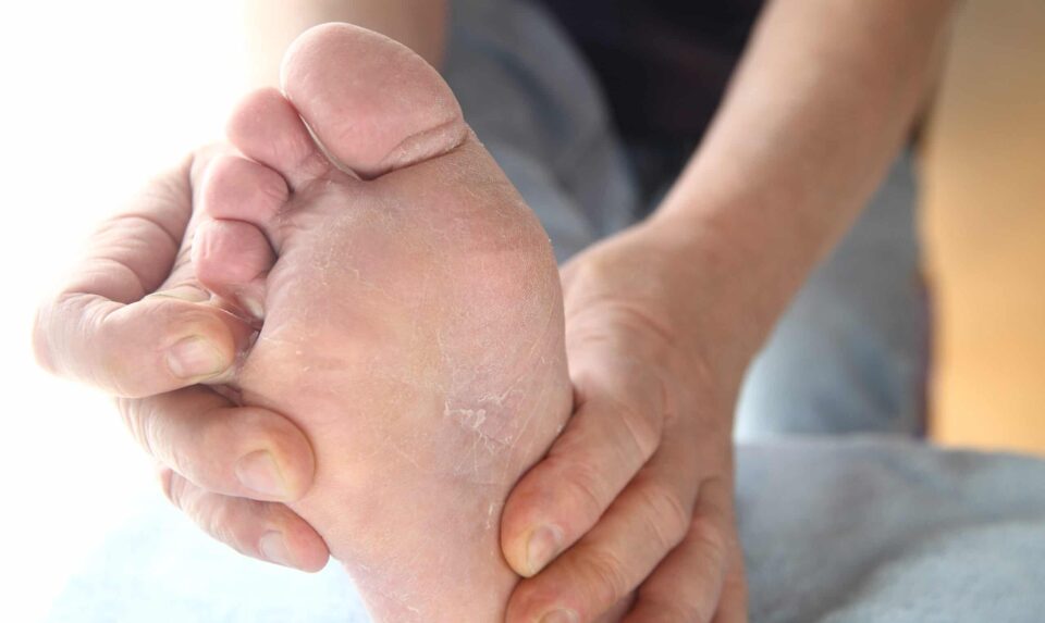 why-are-my-feet-peeling-feet-first-clinic