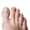 image of a cracked big toenail