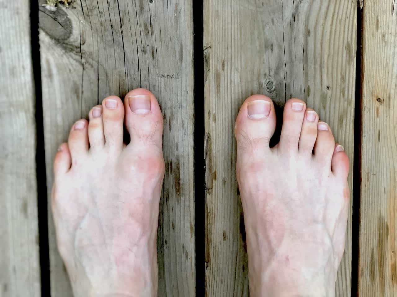 toe bred