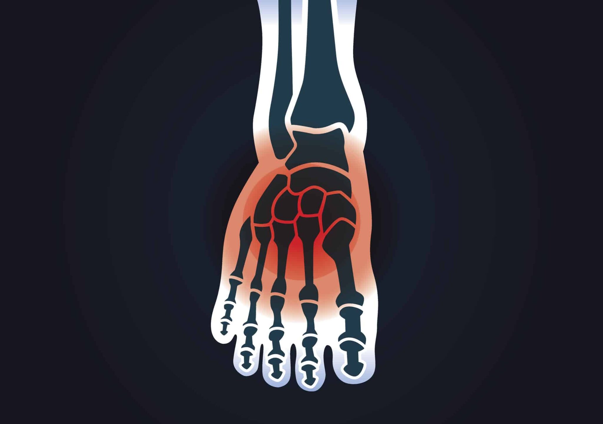 Top of Foot Pain: Causes and Treatment - Feet First Clinic