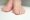 Foot Pain