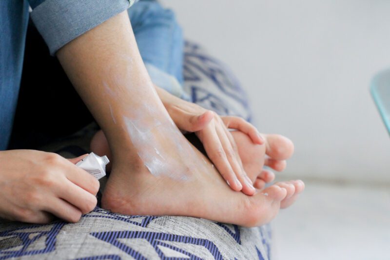 Person applying cream to their foot