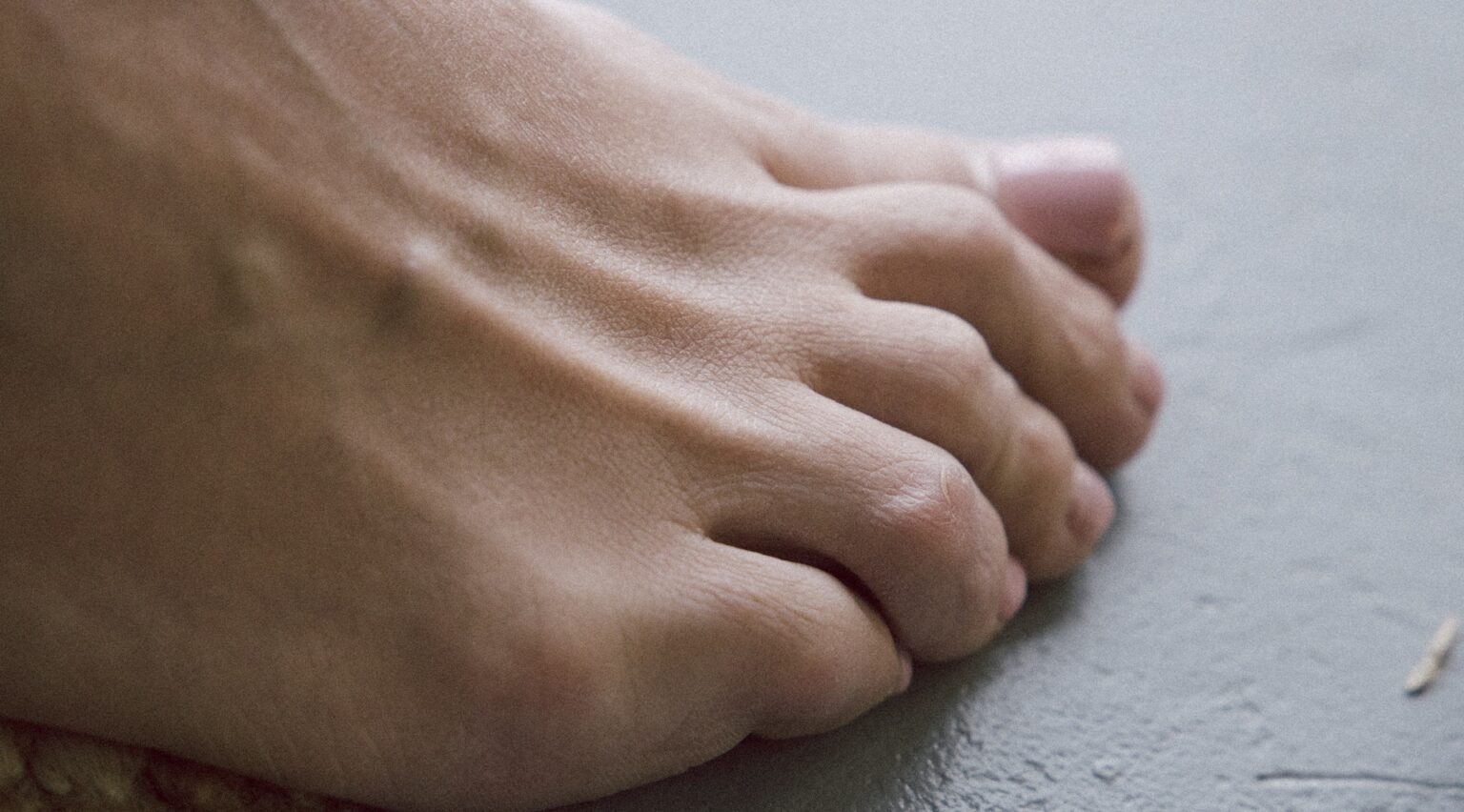 Toenail Anatomy: Exploring the Structure and Functions of Different ...