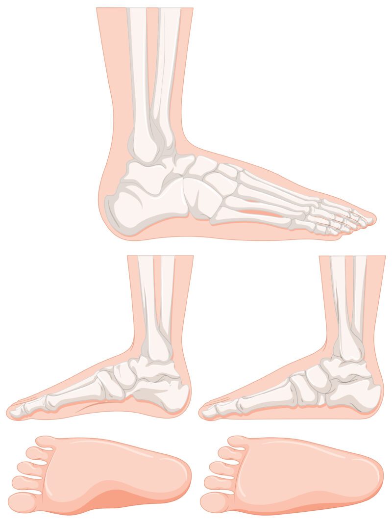 Bones of the foot illustration with different viewpoints