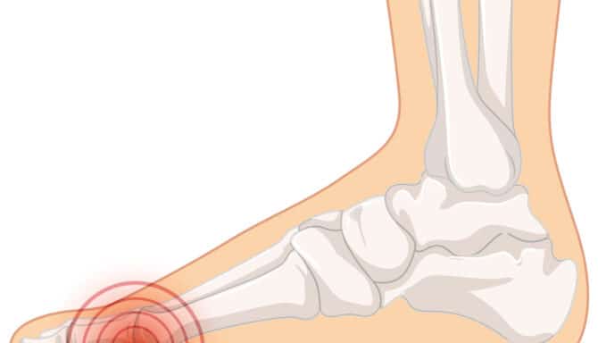 5 Causes for Numb Feet or Toes - Feet First Clinic