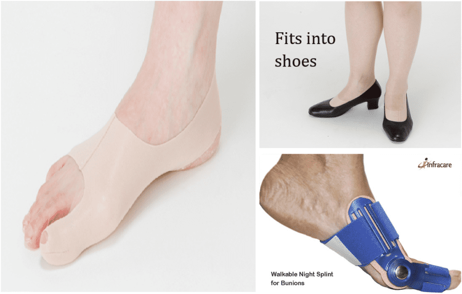 BUNION ALIGNER POSTS