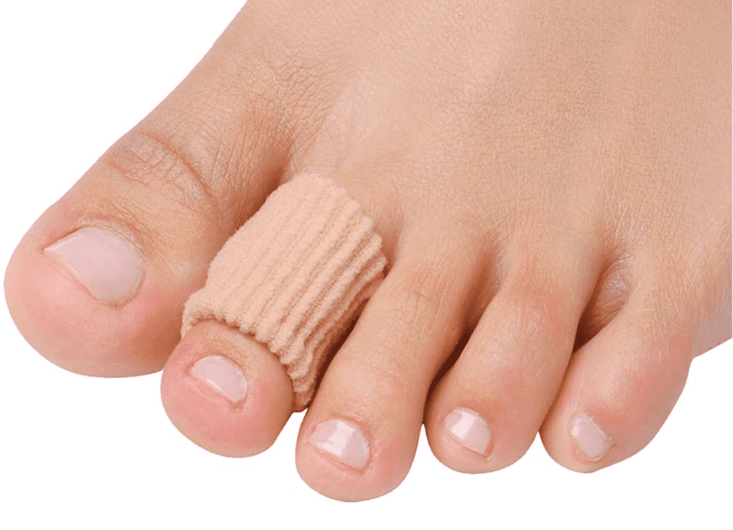 ingrown corn between toes