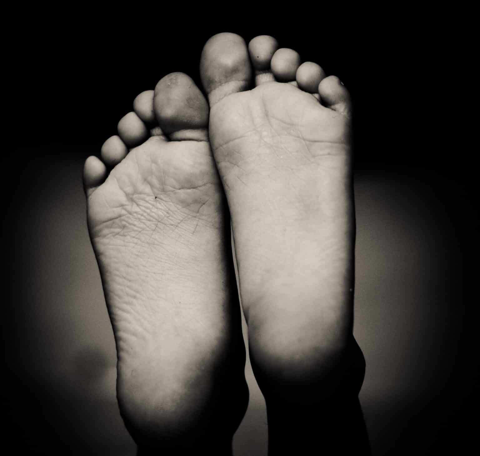 Foot Arch Pain Causes, Prevention, and Treatment Strategies Feet