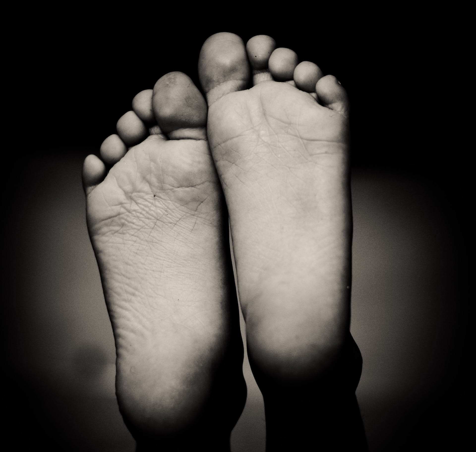 Foot Arch Pain