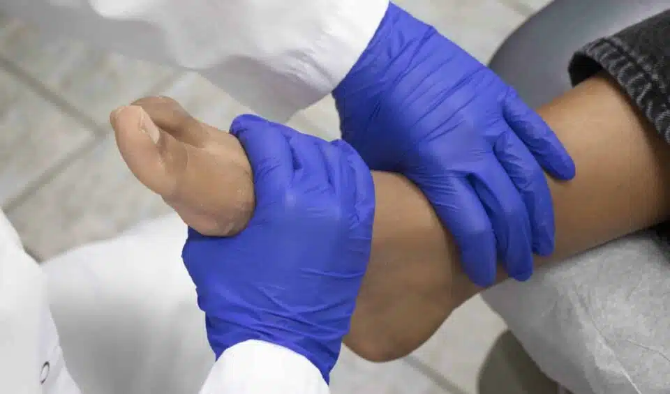 Chiropodist analyzing a patient's foot during a biomechanical assessment