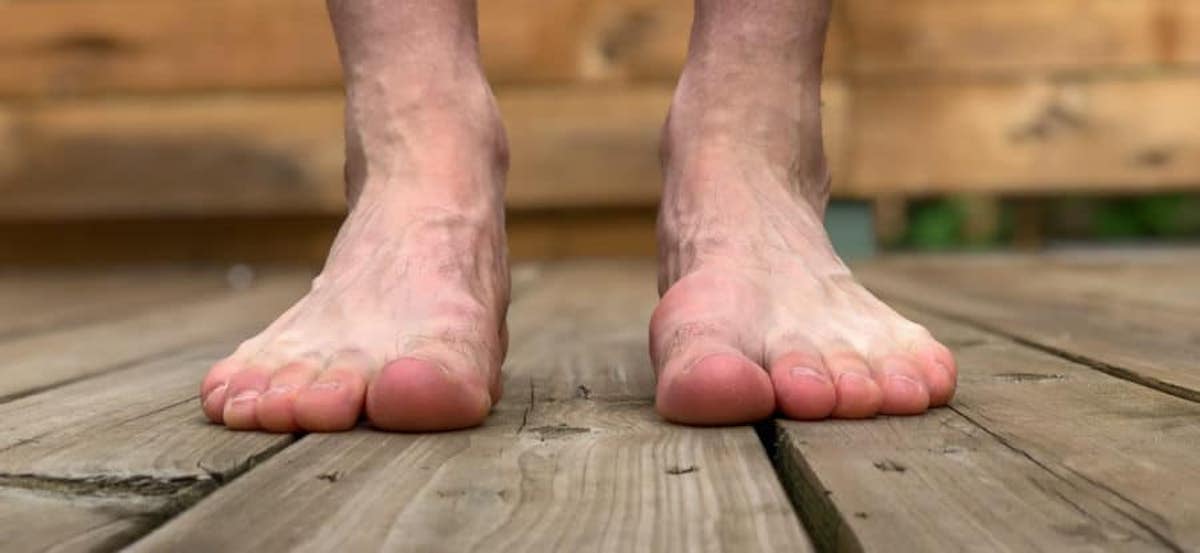 Foot Conditions Elderly