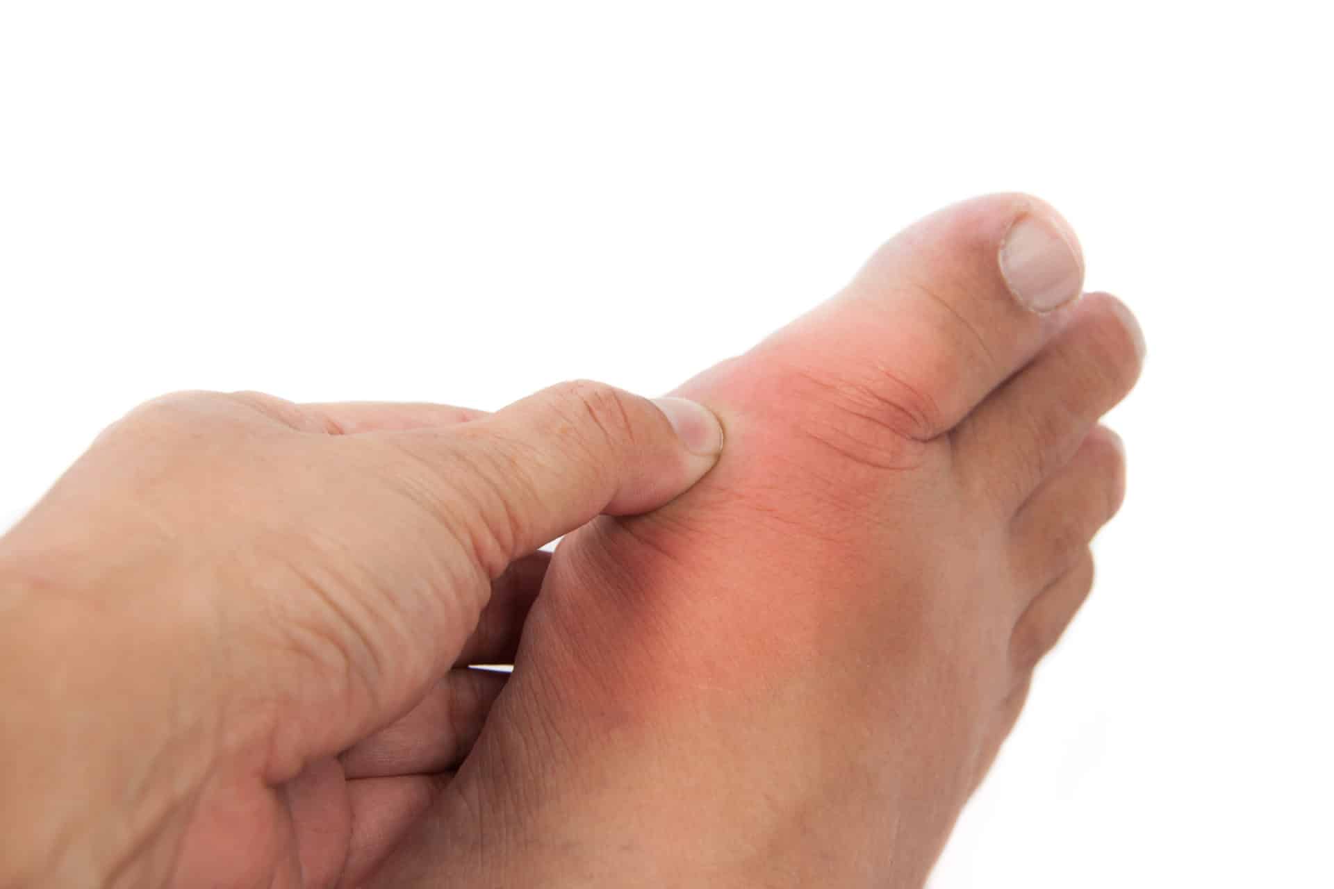 Different Types of Arthritis Feet First Clinic