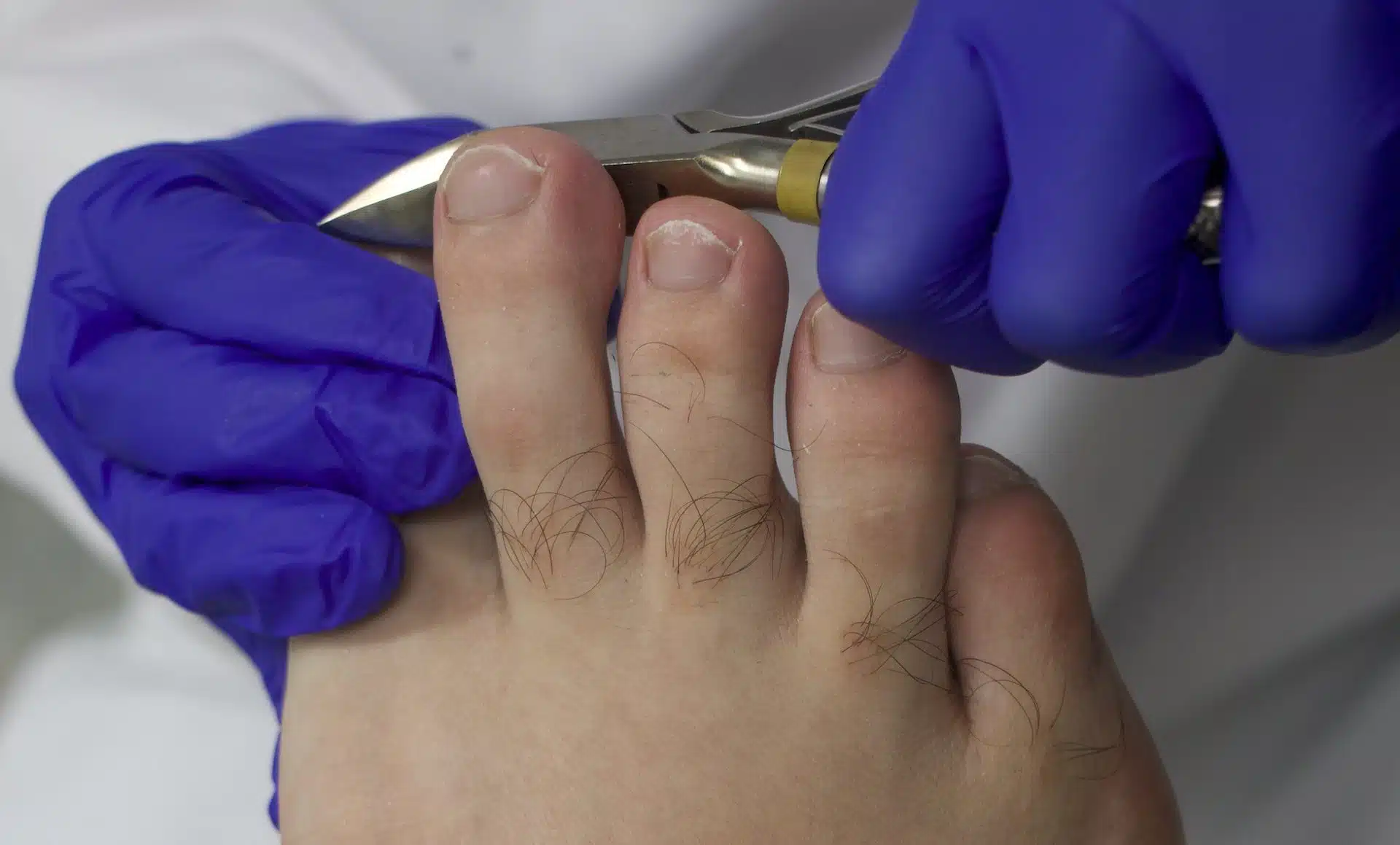 Close up of a toenail being clipped