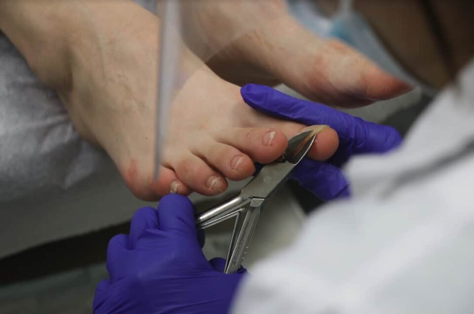 Learn How a Foot Specialist Cuts Toenails Feet First Clinic