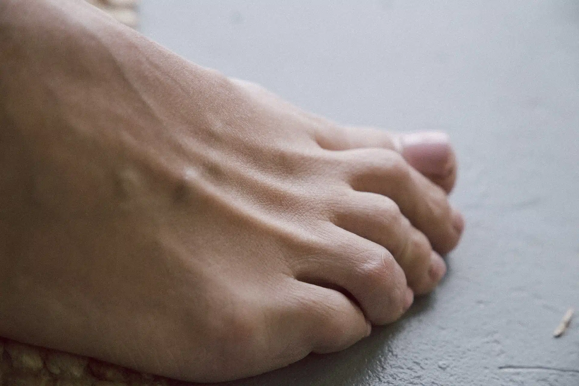 Unraveling the Mysteries: Skin Peeling on Feet and Effective Remedies