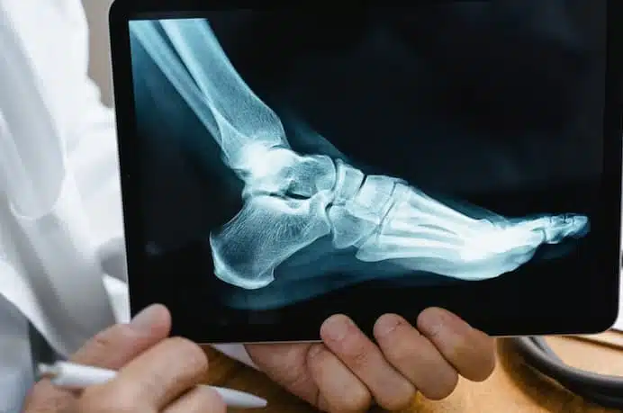 Diagnostic Imaging of Foot Health