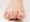 Close up of severely thick toenail big toe