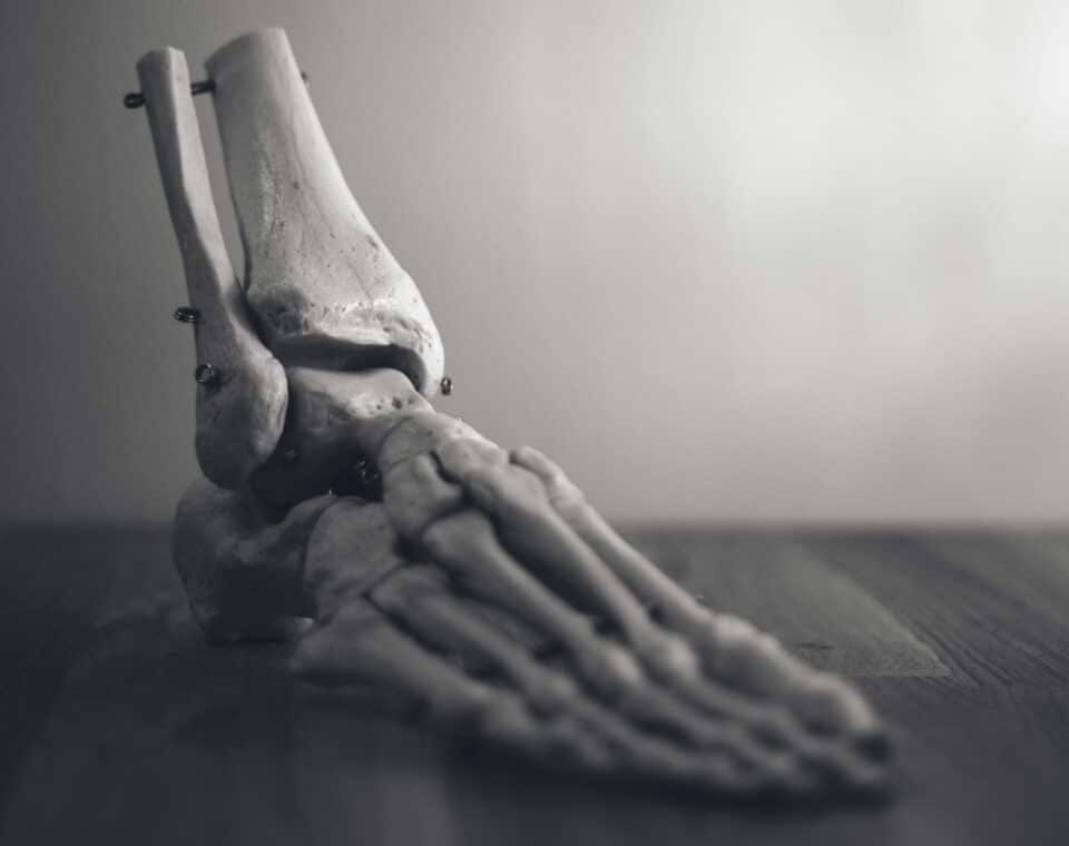 Why Your Ankle Cracks When Rotating A Comprehensive Guide Feet First Clinic