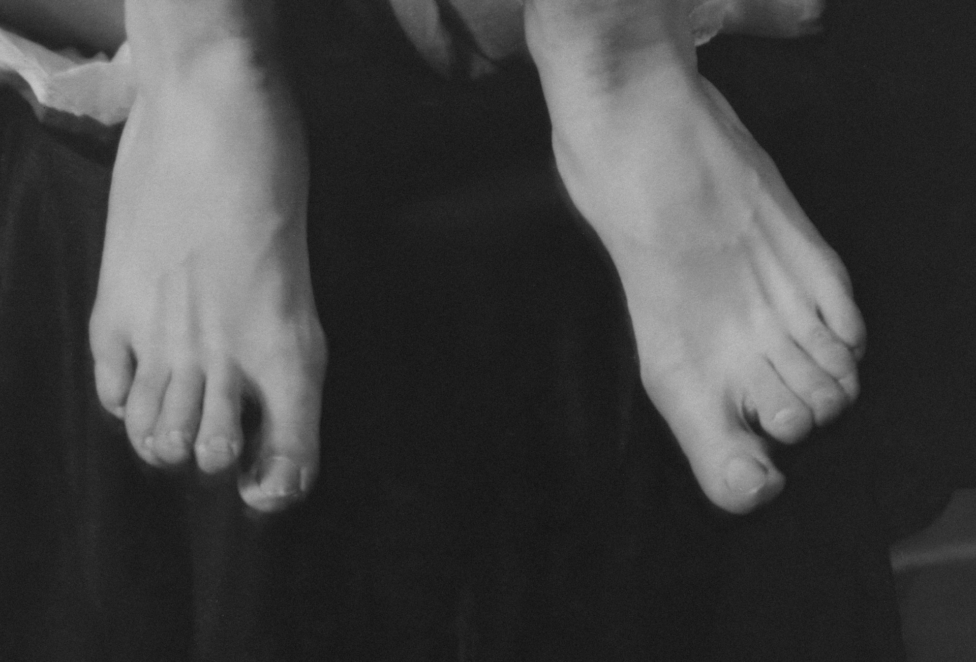 Why Your Ankle Cracks When Rotating A Comprehensive Guide Feet First Clinic