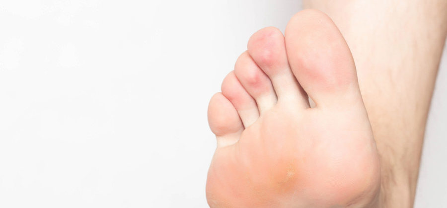 Frequently Asked Questions Corns Feet First Clinic frequently-asked-questions-corns-feet-first-clinic