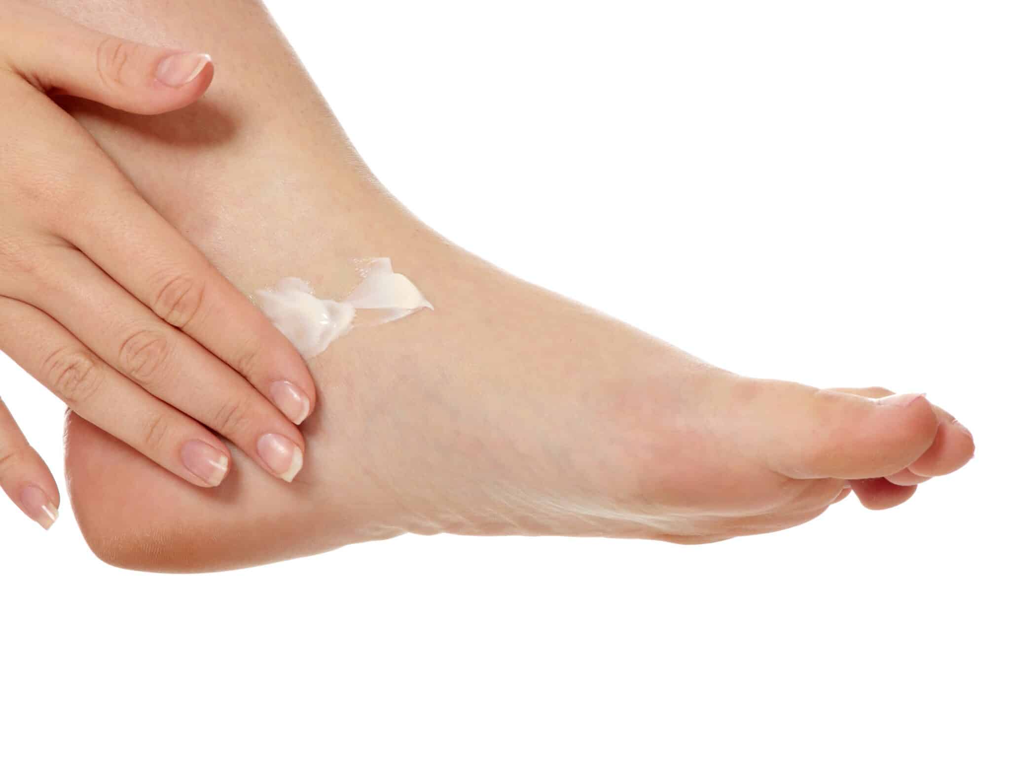 Why Are My Feet Peeling? Feet First Clinic
