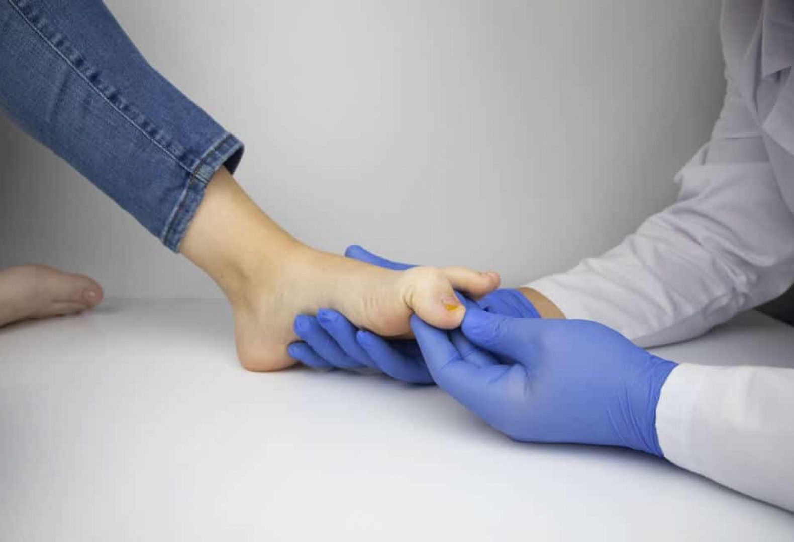 Foot care specialist with gloves inspecting female discoloured toenail