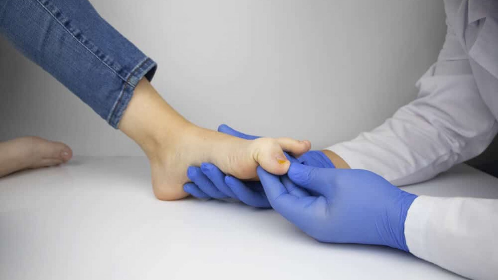 Foot care specialist with gloves inspecting female discoloured toenail