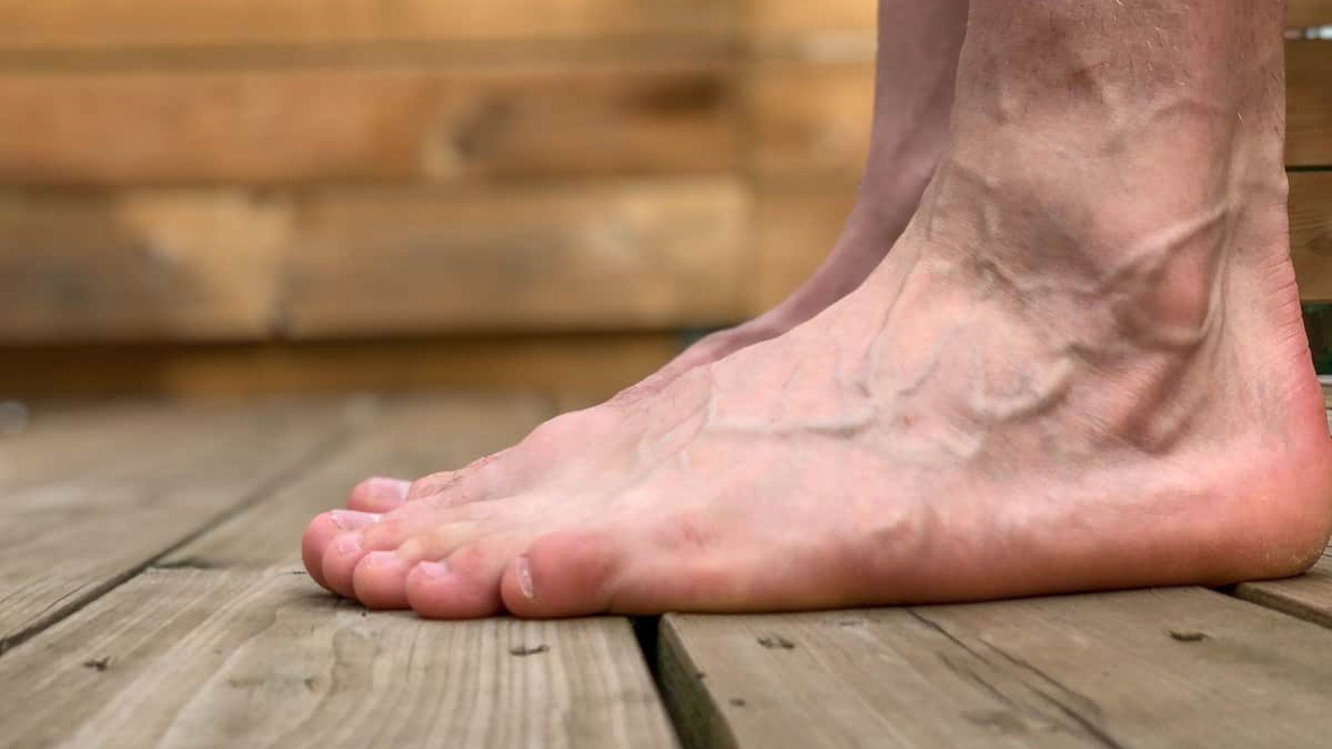 Foot Conditions Elderly