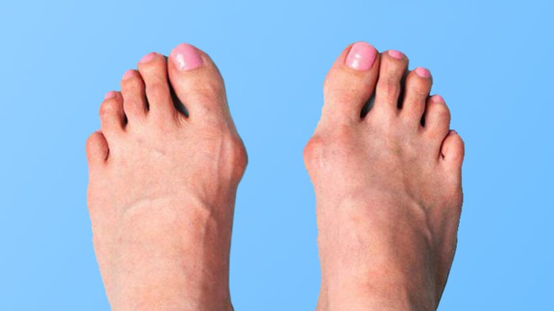 Feet First Clinic Toronto Foot Clinic Foot Specialist Toronto