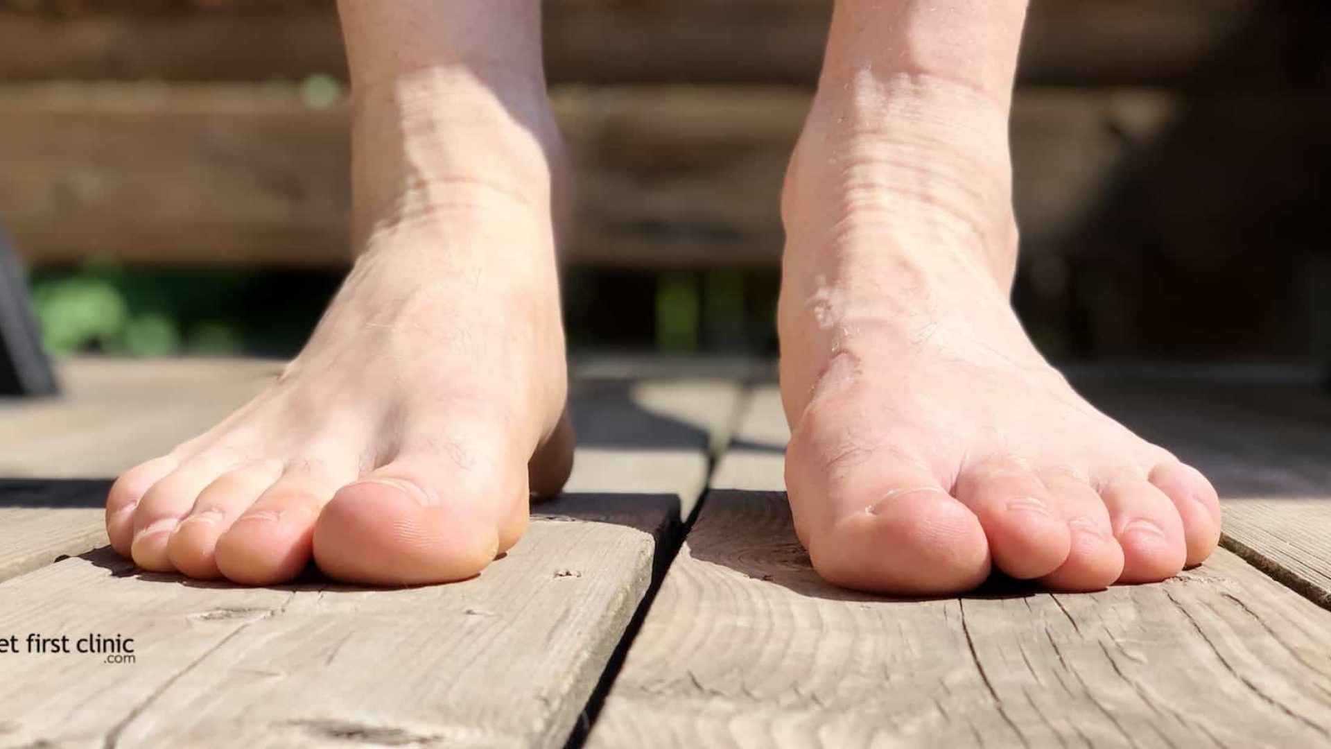 Big Toe Arthritis