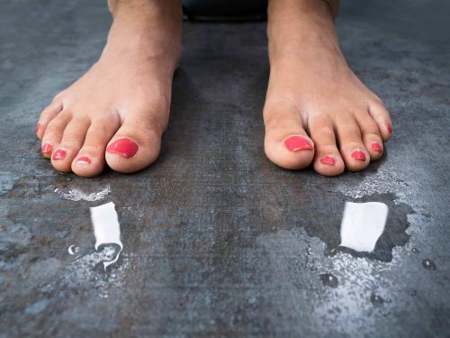 Woman With Sweaty Feet Standing On Floor