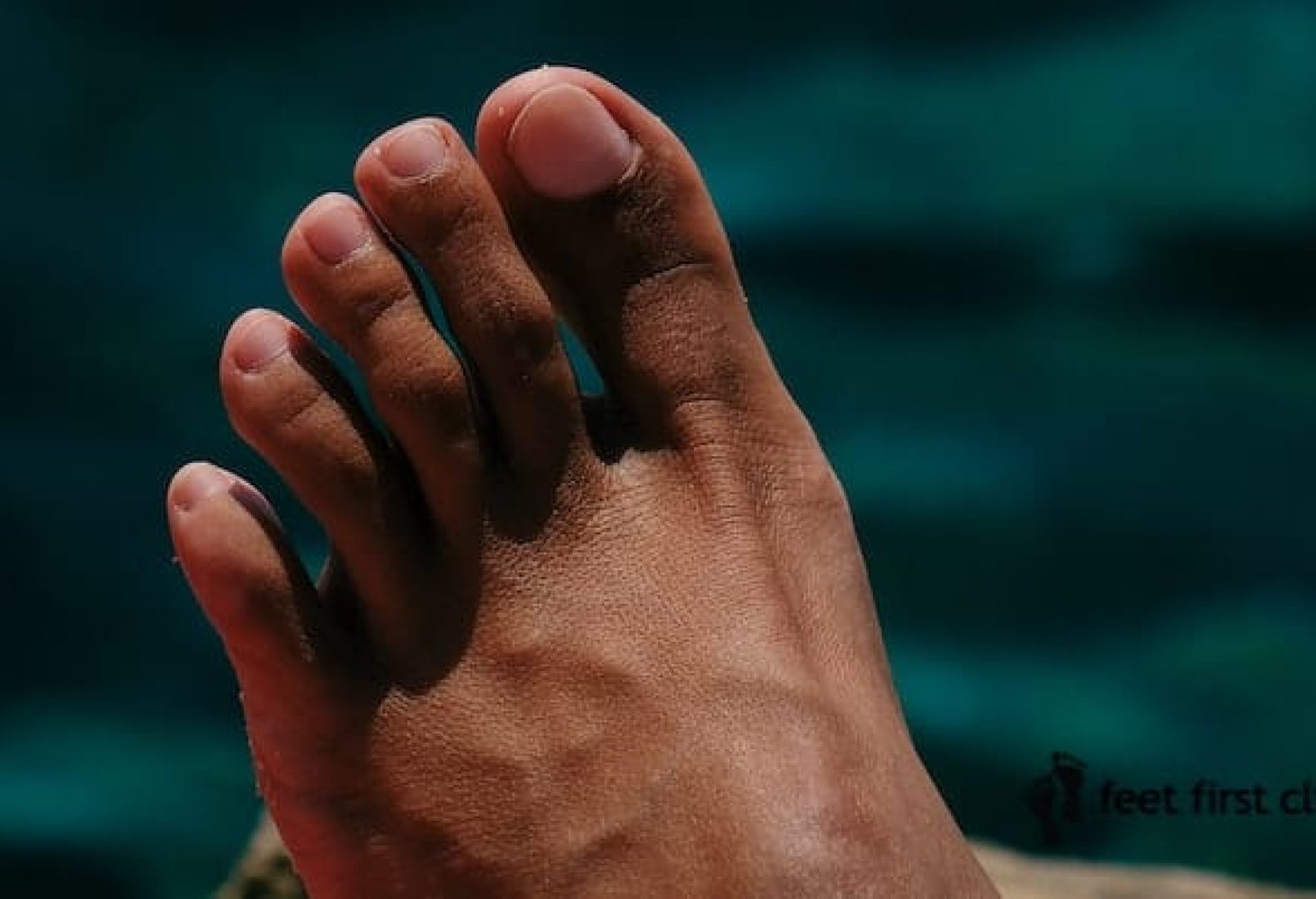 Stubbed Toe