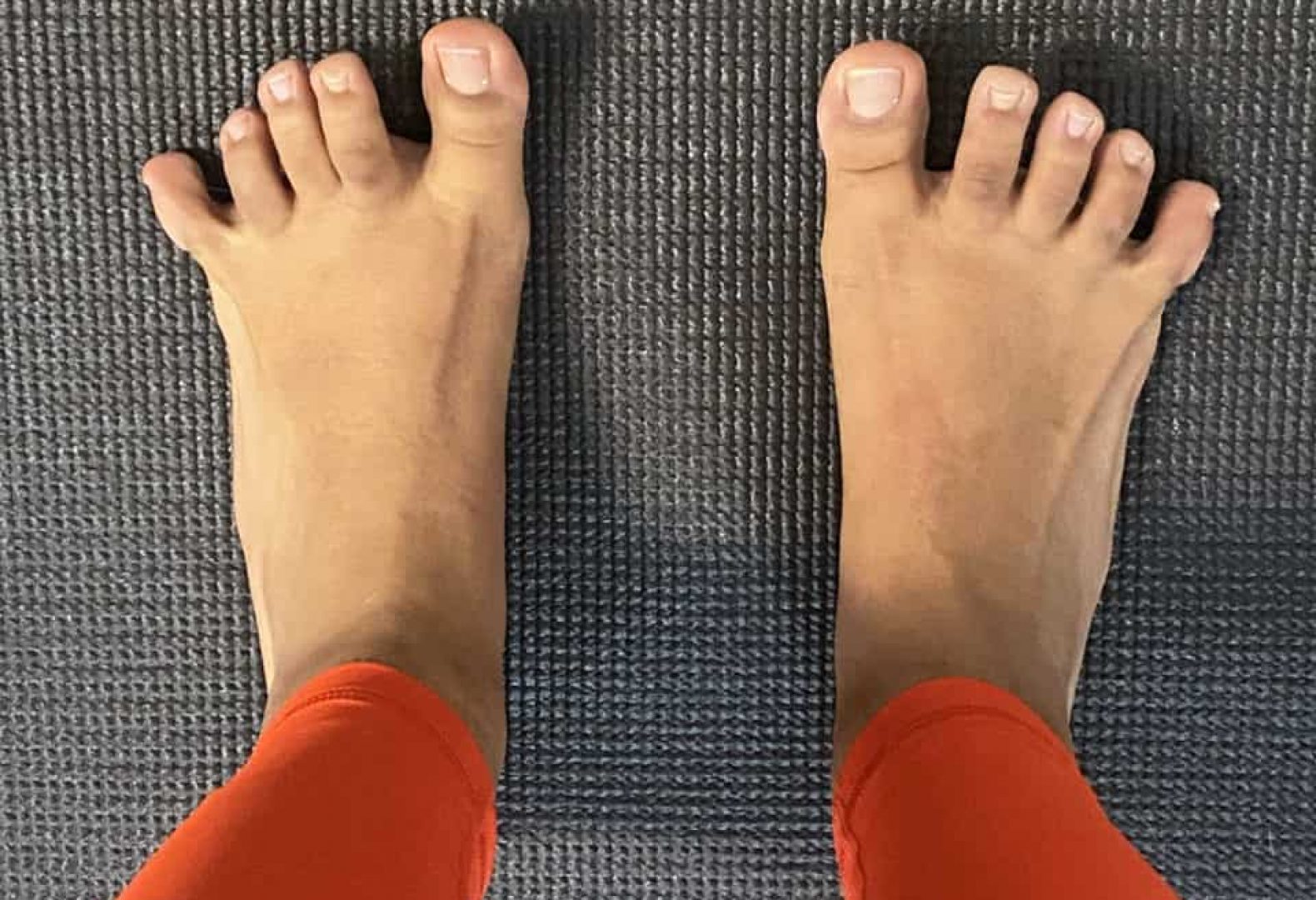 A foot doing a toe-spread exercise by spreading the toes apart.