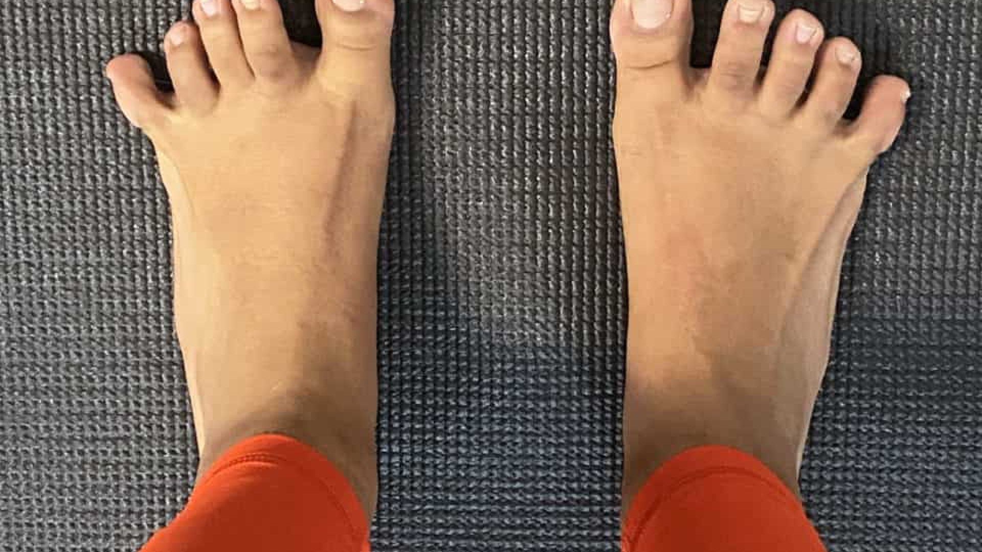 A foot doing a toe-spread exercise by spreading the toes apart.