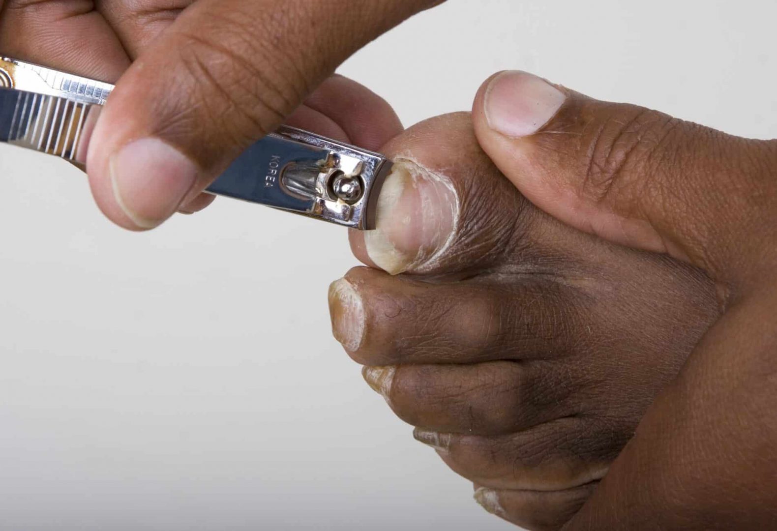 Close up image of clipping thick toenail