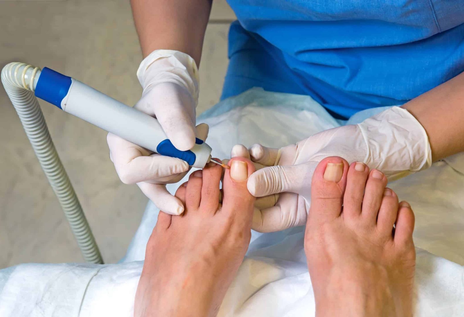 Nail operation in hospital