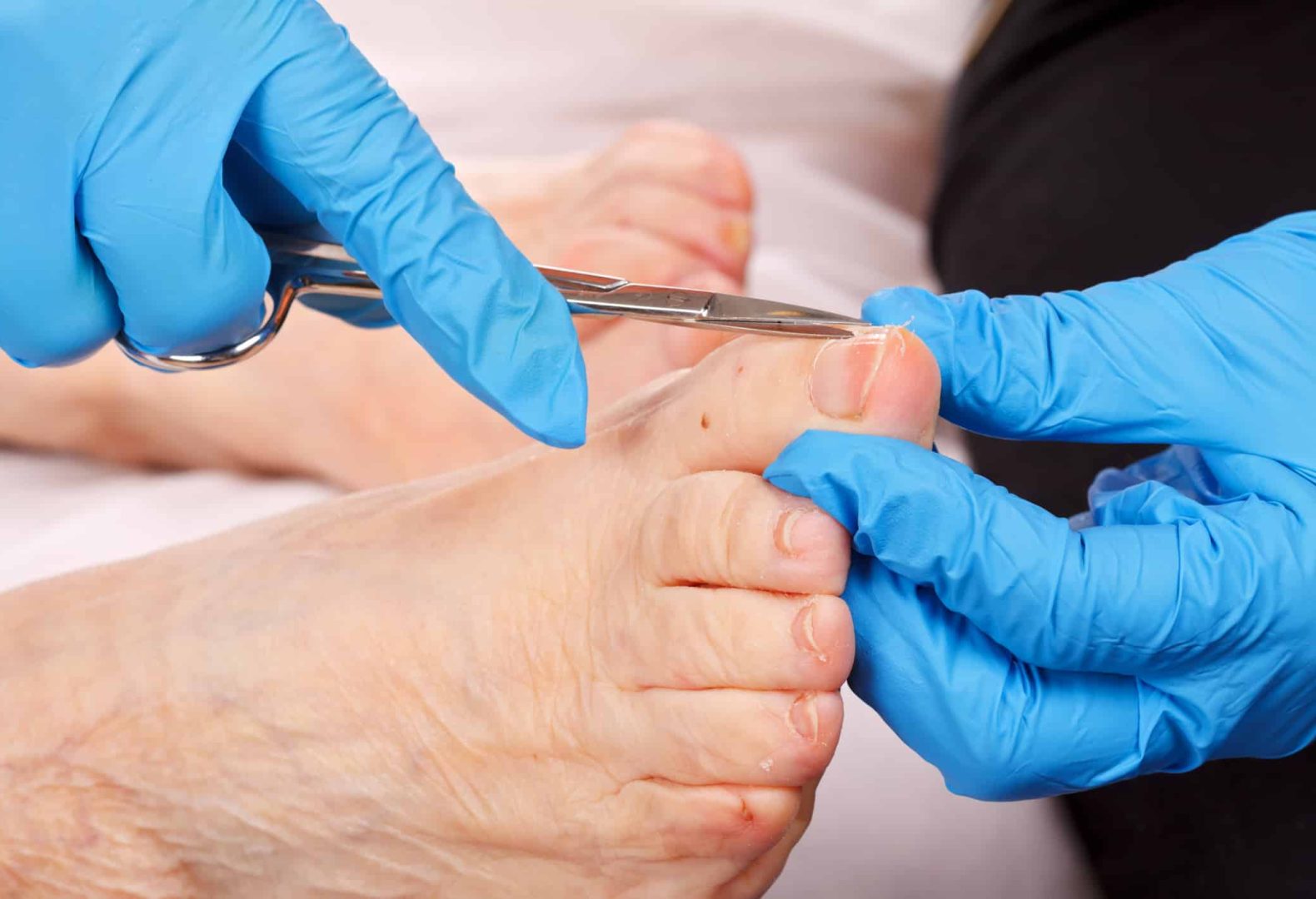 doctor hand examining an elderly patient's foot