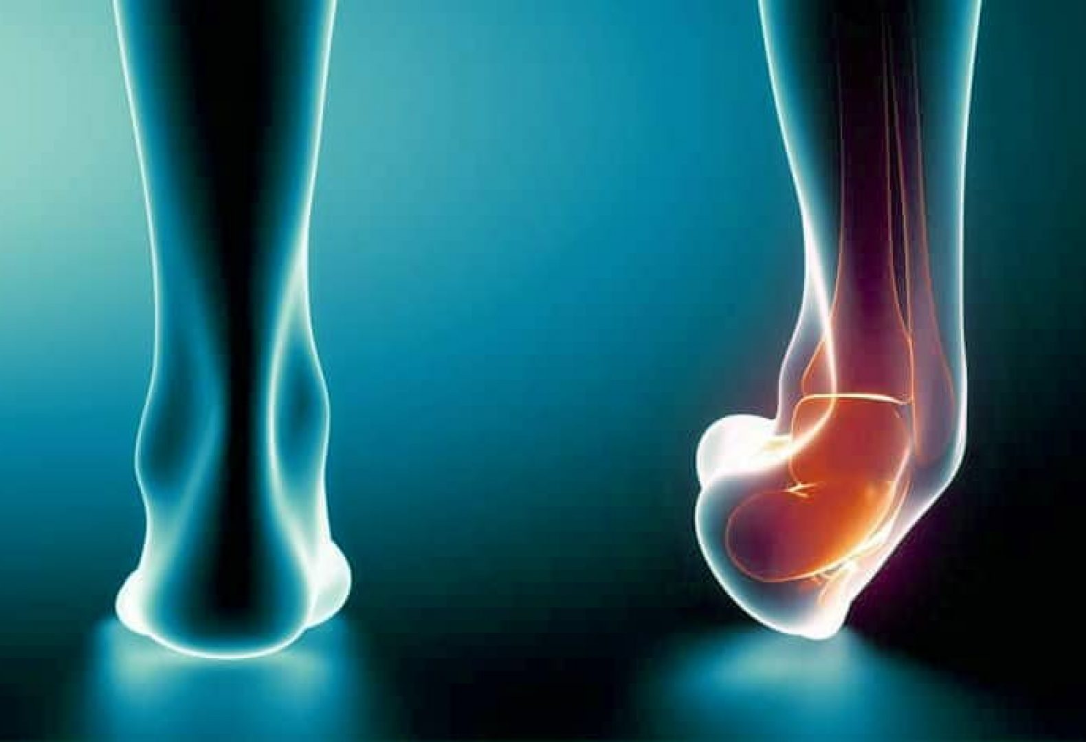 blue and black image of two feet one with a rolled ankle and red insides depicting ankle sprain