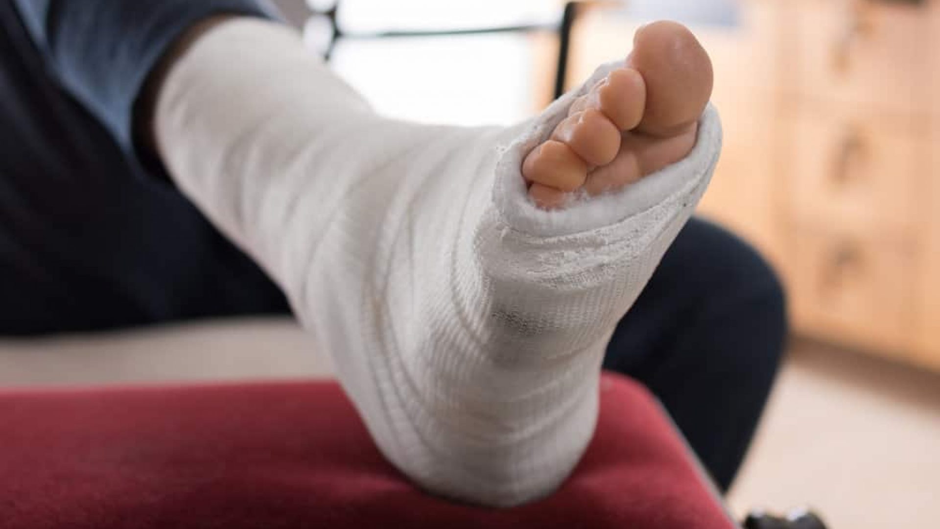 Fiberglass / Plaster leg cas