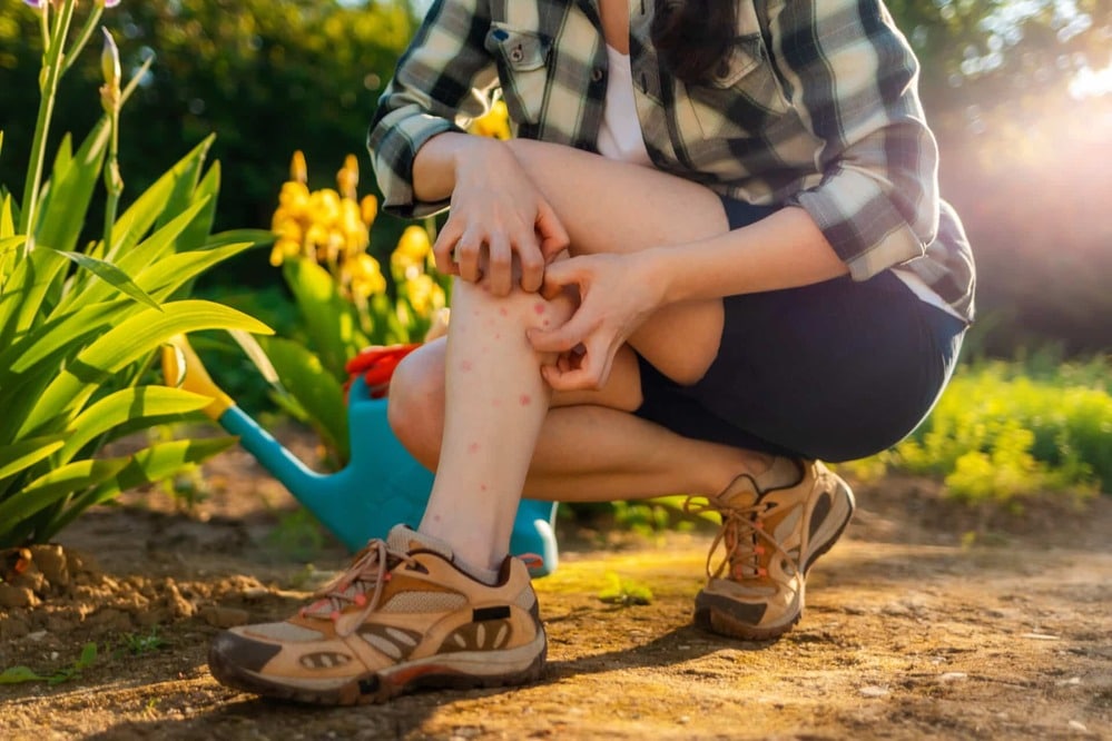 Woman gardening and scratching bug bites on the lower legs
