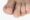 Thick toenail curling inward 