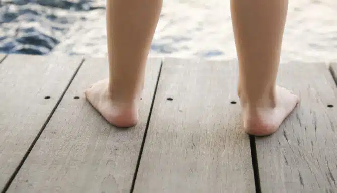 A child with flat feet standing on wooden platform next to the water