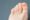 Woman has hard corns and calluses on her toes.