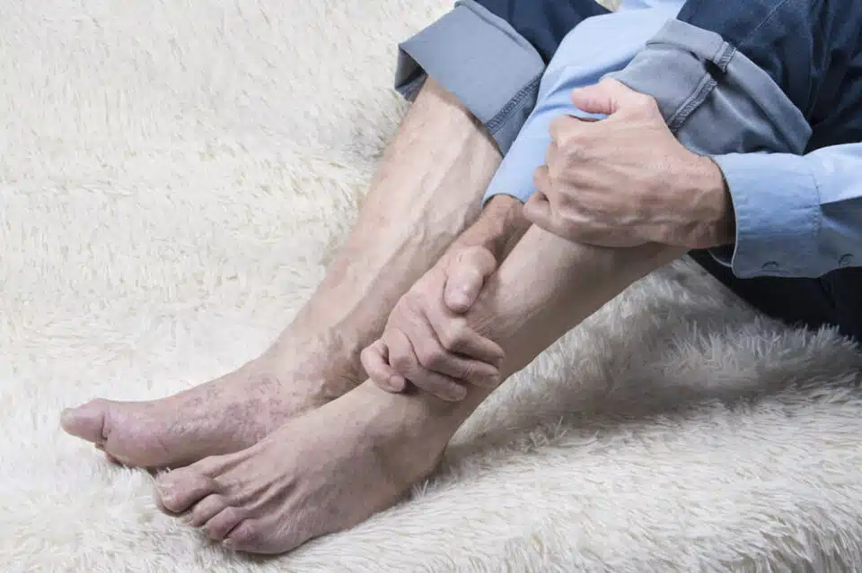 Man clutching his calf and lower leg with his pants rolled up on white carpet