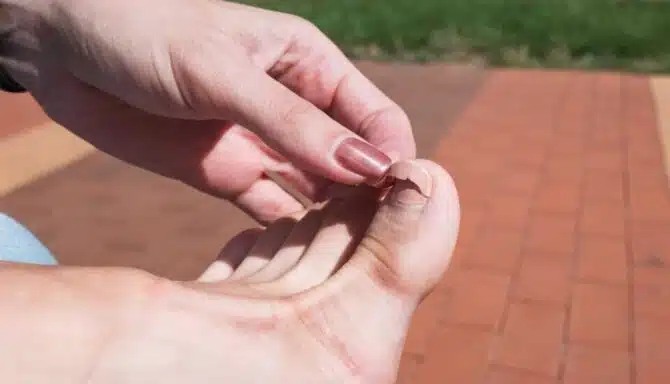 woman with painted finger nails holding painted cracked toenail brick walkway background